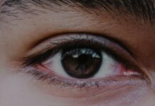 “눈 밑이 칙칙해졌어요”… 다크서클, 단순한 수면 부족이 아닐 수도 있습니다 person's right eye